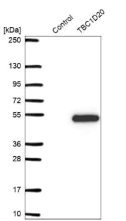 TBC1D20 Antibody, Novus Biologicals 0.1mL; Unlabeled:Antibodies, Polyclonal